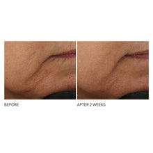 Load image into Gallery viewer, NEW Advanced Retinol + Ferulic Intense Wrinkle Cream