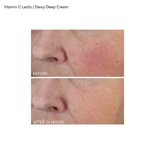 Load image into Gallery viewer, Vitamin C Lactic Dewy Deep Cream
