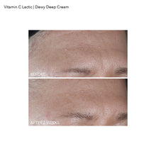 Load image into Gallery viewer, Vitamin C Lactic Dewy Deep Cream
